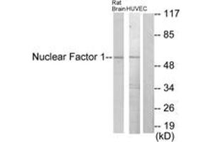 Western blot analysis of extracts from rat brain/HuvEc cells, using Nuclear Factor 1 Antibody. (Nuclear Factor 1 抗体  (AA 11-60))