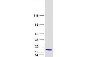 Western Blotting (WB) image for Acyl-CoA Thioesterase 13 (ACOT13) protein (Myc-DYKDDDDK Tag) (ABIN2733555)