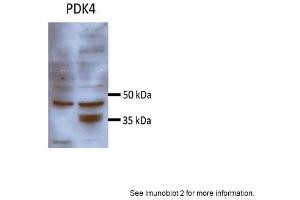 Sample Type: Huh7 HepG2 (50ug)Primary Antibody Dilution: 1:500 Image Submitted By: Partha KasturiUniversity of Kansas Medical Center (PDK4 抗体  (N-Term))