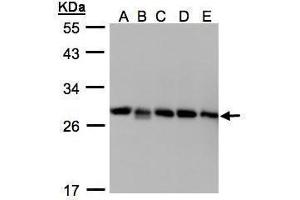 WB Image Sample(30μg whole cell lysate) A: 293T B: A431 , C: H1299 D: HeLa S3 , E: Hep G2 , 12% SDS PAGE antibody diluted at 1:1000 (ARHGDIB 抗体)