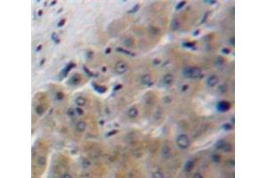 Used in DAB staining on fromalin fixed paraffin-embedded Liver tissue (Apolipoprotein F 抗体  (AA 122-307))
