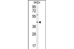DUS4L Antibody (Center) (ABIN654982 and ABIN2844622) western blot analysis in WiDr cell line lysates (35 μg/lane). (DUS4L 抗体  (AA 141-170))