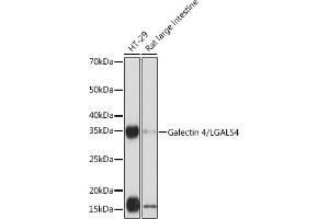 Western blot analysis of extracts of various cell lines, using Galectin 4/LG Rabbit mAb (ABIN1679347, ABIN3017979, ABIN3017980 and ABIN7101554) at 1:1000 dilution. (GAL4 抗体)