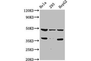 Western Blot Positive WB detected in: Hela whole cell lysate, 293 whole cell lysate, HepG2 whole cell lysate All lanes: SOX4 antibody at 1:2000 Secondary Goat polyclonal to rabbit IgG at 1/50000 dilution Predicted band size: 48 kDa Observed band size: 48 kDa (SOX4 抗体  (AA 1-60))
