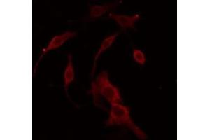 ABIN6266814 staining COLO205 cells by IF/ICC. (LRAT 抗体  (Internal Region))
