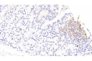 Detection of IL1RA in Rabbit Colon Tissue using Polyclonal Antibody to Interleukin 1 Receptor Antagonist (IL1RA) (IL1RN 抗体  (AA 26-177))