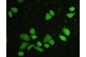 Detection of CASP8 in Hela cells using Polyclonal Antibody to Caspase 8 (CASP8) (Caspase 8 抗体  (AA 7-201))