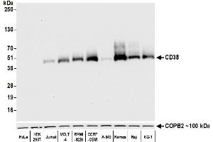 Western Blotting (WB) image for anti-CD38 (AA 43-300) antibody (ABIN7453961) (Recombinant CD38 抗体  (AA 43-300))