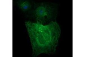 Image no. 1 for anti-Tubulin, beta 2A (TUBB2A) antibody (ABIN1501567) (TUBB2A 抗体)