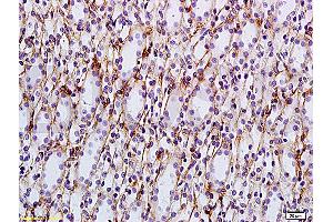 Formalin-fixed and paraffin embedded: rat kidney tissue labeled with Anti-AQP-2 Polyclonal Antibody, Unconjugated (ABIN1385618) at 1:200, followed by conjugation to the secondary antibody and DAB staining (AQP2 抗体  (AA 101-200))