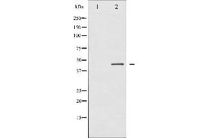 Western blot analysis of Connexin 43 phosphorylation expression in PMA treated K562 whole cell lysates,The lane on the left is treated with the antigen-specific peptide.