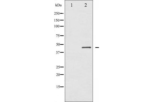 Connexin 43/GJA1 抗体  (pSer368)
