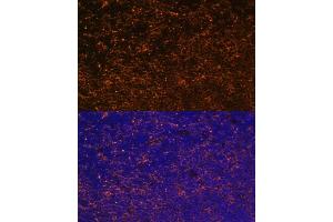 Immunofluorescence analysis of mouse thymus using CD27 antibody (ABIN3022680, ABIN3022681, ABIN3022682 and ABIN6219092) at dilution of 1:100. (CD27 抗体  (AA 20-191))