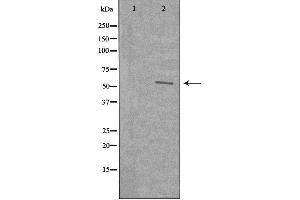Western blot analysis of extracts from 3T3 cells using WASF3 antibody. (WASF3 抗体  (Internal Region))