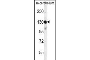 Western blot analysis of KIT Antibody  g in mouse cerebellum tissue lysates (35 μg/lane). (KIT 抗体  (AA 680-711))