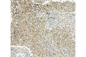 IHC analysis of ALDOA using anti-ALDOA antibody (ABIN7601907). (ALDOA 抗体  (AA 50-364))