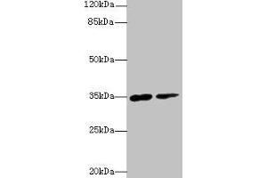 Western blot All lanes: RNF148 antibody at 6 μg/mL Lane 1: Hela whole cell lysate Lane 2: HepG2 whole cell lysate Secondary Goat polyclonal to rabbit IgG at 1/10000 dilution Predicted band size: 35 kDa Observed band size: 35 kDa (RNF148 抗体  (AA 208-305))