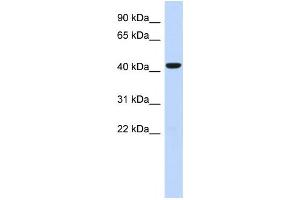 Western Blotting (WB) image for anti-Sphingomyelin Synthase 2 (SGMS2) antibody (ABIN2459622) (Sphingomyelin Synthase 2 抗体)