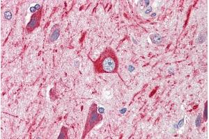 ABIN184877 (5µg/ml) staining of paraffin embedded Human Cortex. (PRDM11 抗体  (C-Term))