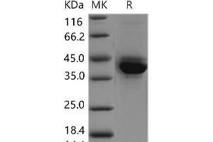 Western Blotting (WB) image for S100 Calcium Binding Protein A4 (S100A4) protein (Fc Tag) (ABIN7320263)