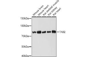 Western blot analysis of extracts of various cell lines, using T antibody (ABIN6131433, ABIN6148797, ABIN6148798 and ABIN6225202) at 1:1000 dilution. (TAB2 抗体  (AA 350-693))
