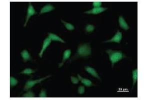 Immunostaining analysis in HeLa cells. (FKBP3 抗体)