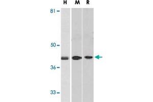 Western blot analysis of DAPK2 in A-431 (H), mouse spleen (M), and rat kidney (R) lysates with DAPK2 polyclonal antibody  at 1 ug/mL . (DAPK2 抗体  (C-Term))