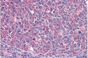 ABIN570765 (3. (ICOS 抗体  (Internal Region))