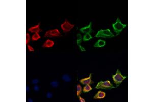 ABIN6258875 and ABIN6274225 staining Hela cells by IF/ICC. (LTK 抗体  (Internal Region))