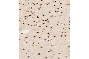 Immunohistochemical analysis of paraffin-embedded human brain tissue using (ABIN1539662 and ABIN2848878) performed on the Leica® BOND RXm.