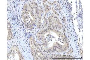 IHC analysis of RBM22 using anti-RBM22 antibody (ABIN7600268).