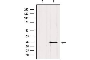Western blot analysis of extracts from Mouse brain, using MIXL1 Antibody. (MIXL1 抗体  (Internal Region))