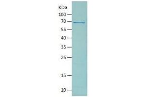 GFAP Protein (AA 1-430) (His-IF2DI Tag)
