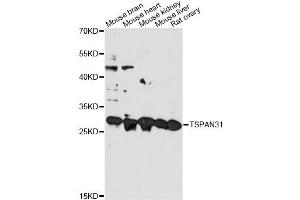 Western blot analysis of extracts of various cell lines, using TSPAN31 antibody. (TSPAN31 抗体)