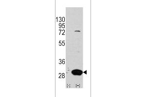 Western blot analysis of Latexin using rabbit polyclonal Latexin Antibody using 293 cell lysates (2 ug/lane) either nontransfected (Lane 1) or transiently transfected with the LXN gene (Lane 2). (Latexin 抗体  (AA 78-107))