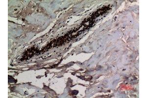 Immunohistochemistry (IHC) analysis of paraffin-embedded Human Breast, antibody was diluted at 1:100. (KRT8 抗体  (acLys483))