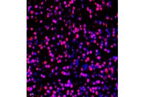 Immunofluorescence of paraffin embedded rat embryonic rat using BRN3A (ABIN7075163) at dilution of 1:650 (400x lens) (POU4F1 抗体)