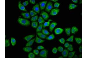 Immunofluorescence staining of Hela cells with ABIN7146664 at 1:66, counter-stained with DAPI. (Caprin-1 抗体  (AA 573-703))