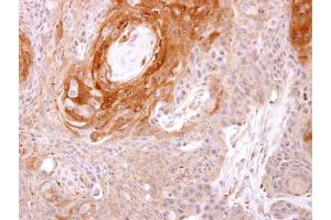 IHC-P Image Prostasin antibody [N1C2] detects Prostasin protein at cytosol on Ca922 xenograft by immunohistochemical analysis. (PRSS8 抗体  (Center))