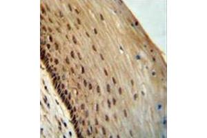 Formalin fixed, paraffin embedded human cervical tissue stained with SPDYE3 Antibody  followed by peroxidase conjugation of the secondary antibody and DAB staining. (SPDYE3 抗体  (Middle Region))