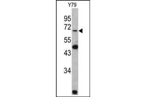 Western blot: Lamin B2 Antibody staining of Y79 cell line lysates (35 µg/lane). (Lamin B2 抗体  (C-Term))