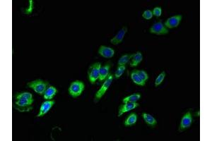 Immunofluorescent analysis of HepG2 cells using ABIN7172926 at dilution of 1:100 and Alexa Fluor 488-congugated AffiniPure Goat Anti-Rabbit IgG(H+L) (TM4SF1 抗体  (AA 115-161))