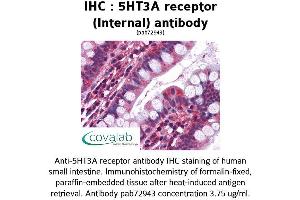Image no. 1 for anti-Serotonin Receptor 3A (HTR3A) (Internal Region) antibody (ABIN1731371)