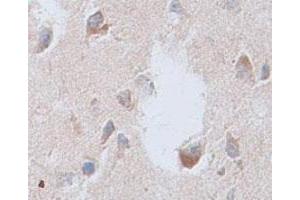 Immunohistochemical staining of formalin-fixed paraffin-embedded human brain tissue showing membrane staining with CNTFR polyclonal antibody  at 1 : 100 dilution. (CNTF Receptor alpha 抗体  (Internal Region))
