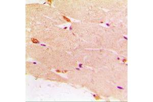 Immunohistochemical analysis of Desmin staining in human muscle formalin fixed paraffin embedded tissue section. (Desmin 抗体  (C-Term))