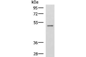 Western blot analysis of Human placenta tissue lysate using GRWD1 Polyclonal Antibody at dilution of 1:800 (GRWD1 抗体)