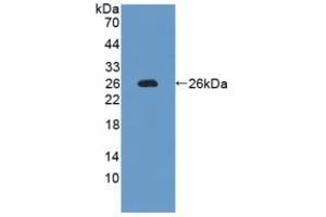 Detection of Recombinant IL12A, Rat using Polyclonal Antibody to Interleukin 12A (IL12A) (IL12A 抗体  (AA 23-215))