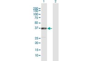 Western Blot analysis of ACAT2 expression in transfected 293T cell line by ACAT2 MaxPab polyclonal antibody. (ACAT2 抗体  (AA 1-397))
