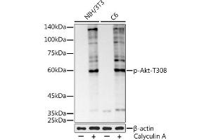 Western blot analysis of extracts of various cell lines, using Phospho-Akt-T308 antibody (ABIN7271240) at 1:1000 dilution.