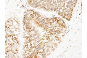 Immunohistochemistry (IHC) image for anti-A Kinase (PRKA) Anchor Protein 1 (AKAP1) (AA 375-425) antibody (ABIN7448928) (AKAP1 抗体  (AA 375-425))